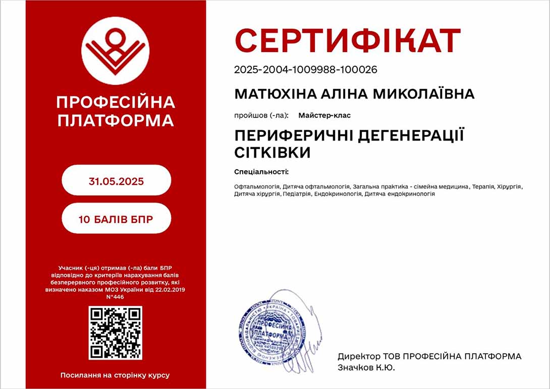 Житомир дегенерація сітківки